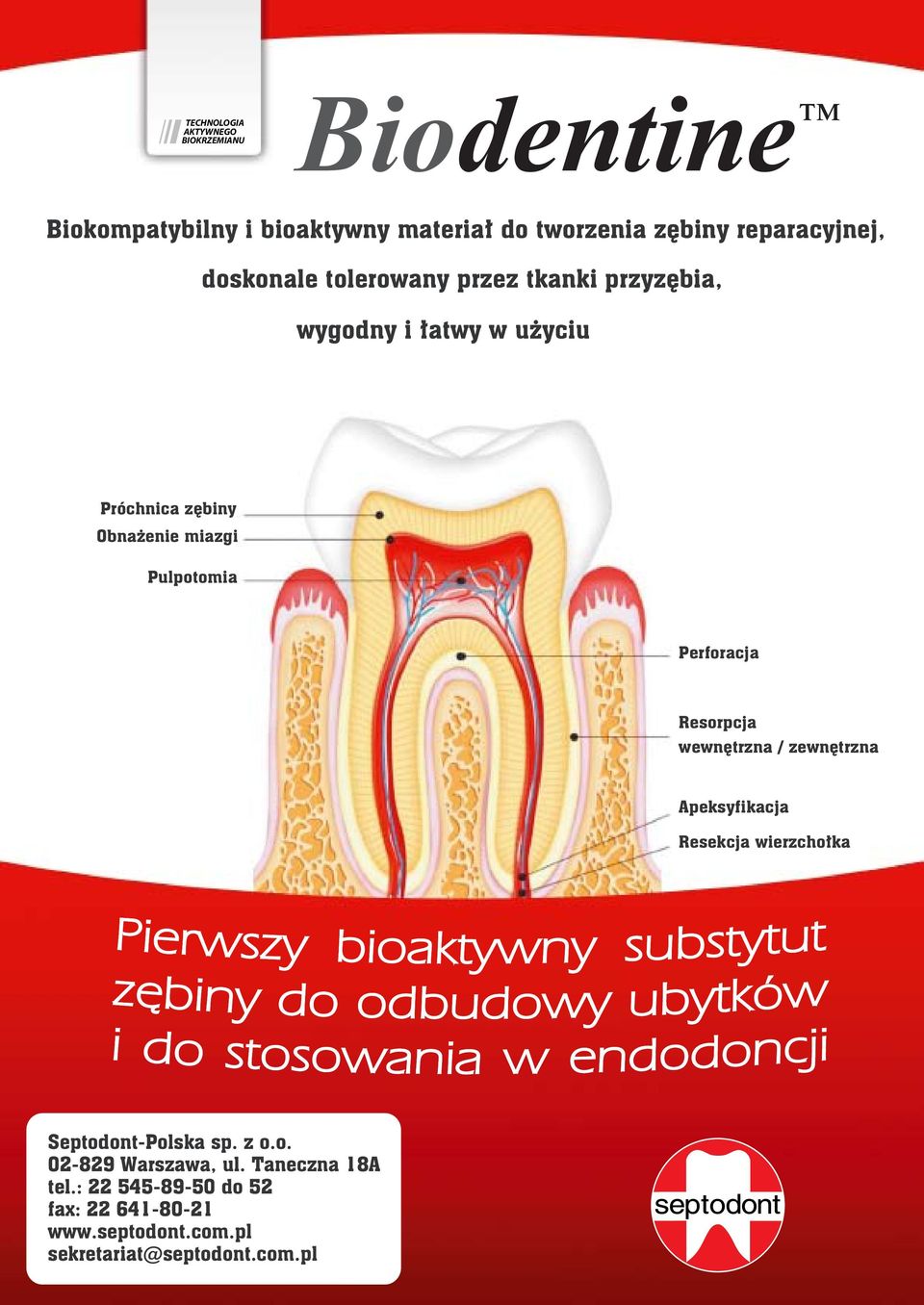 miazgi Pulpotomia Perforacja Resorpcja wewnętrzna / zewnętrzna Apeksyfikacja Resekcja wierzchołka Septodont-Polska