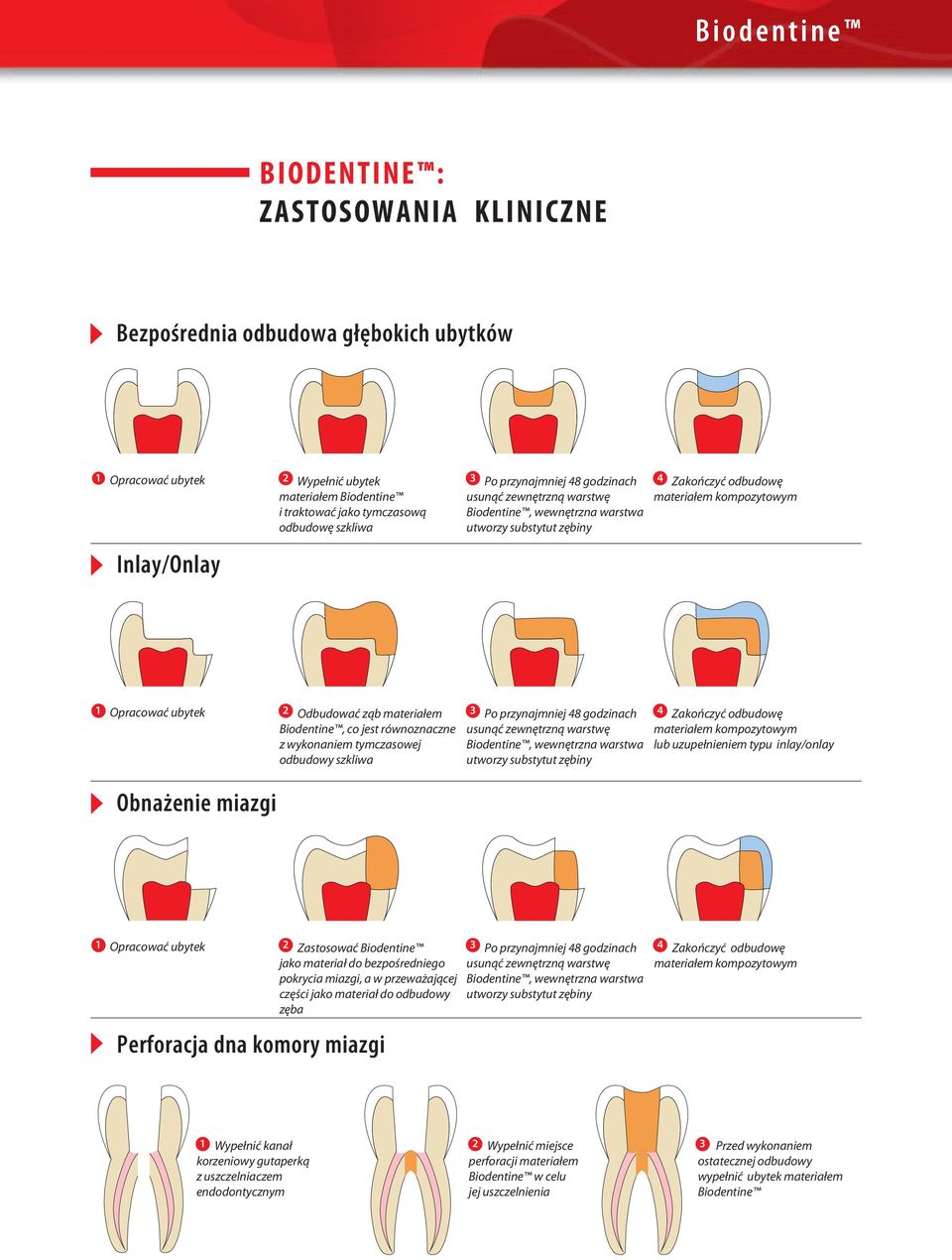 wykonaniem tymczasowej odbudowy szkliwa Obnażenie miazgi 3 Po przynajmniej 48 godzinach 4 Zakończyć odbudowę usunąć zewnętrzną warstwę, wewnętrzna warstwa materiałem kompozytowym lub uzupełnieniem