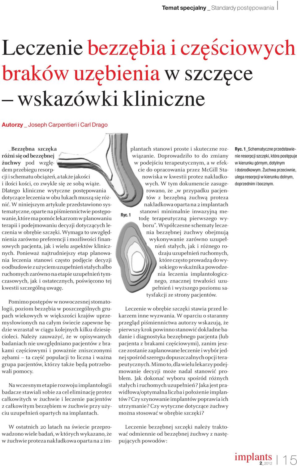 W niniejszym artykule przedstawiono systematyczne, oparte na piśmiennictwie postępowanie, które ma pomóc lekarzom w planowaniu terapii i podejmowaniu decyzji dotyczących leczenia w obrębie szczęki.