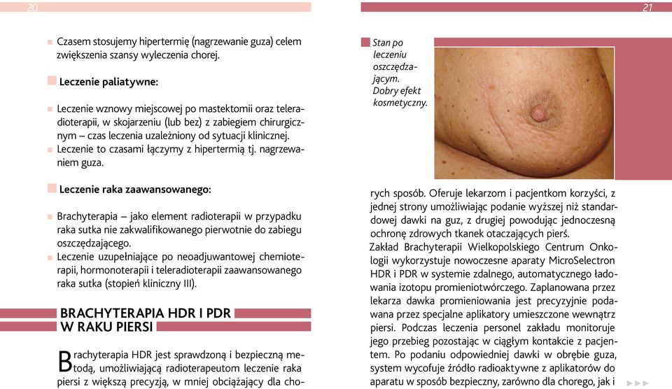 Leczenie to czasami łączymy z hipertermią tj. nagrzewaniem guza.