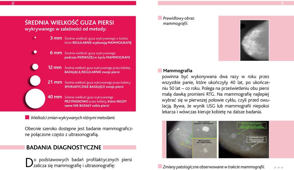 wykrywanego przez kobietę, BADAJĄCĄ REGULARNIE swoje piersi 21 mm Średnia wielkość guza wykrywanego przez kobiety, SPORADYCZNIE BADAJĄCE swoje piersi 40 mm Średnia wielkość guza wykrywanego