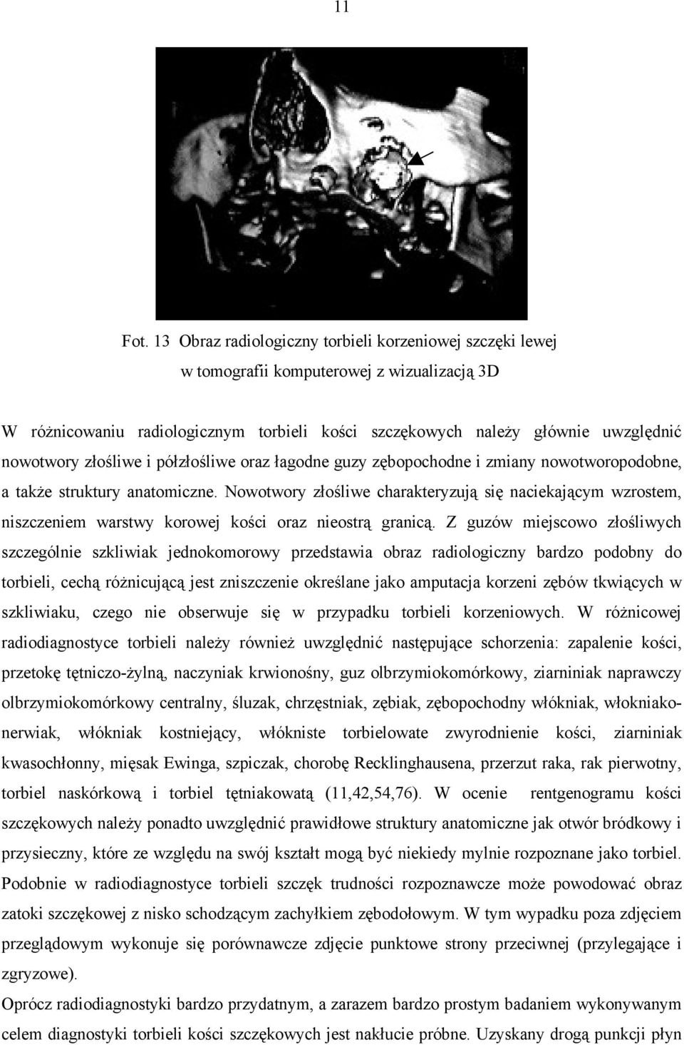 złośliwe i półzłośliwe oraz łagodne guzy zębopochodne i zmiany nowotworopodobne, a także struktury anatomiczne.