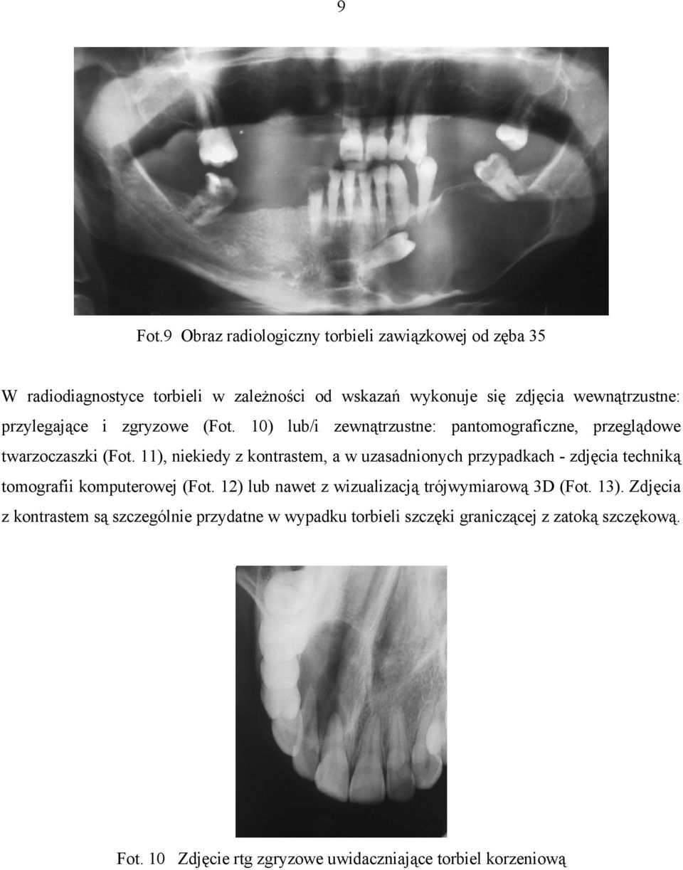 przylegające i zgryzowe (Fot. 10) lub/i zewnątrzustne: pantomograficzne, przeglądowe twarzoczaszki (Fot.