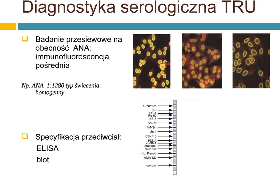 immunofluorescencja pośrednia Np.