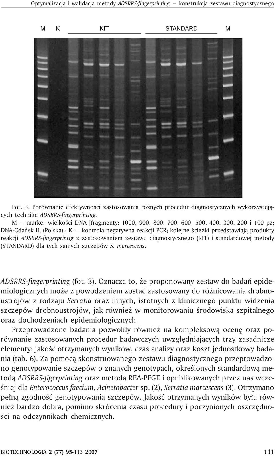 M marker wielkoœci DNA [fragmenty: 1000, 900, 800, 700, 600, 500, 400, 300, 200 i 100 pz; DNA-Gdañsk II, (Polska)]; K kontrola negatywna reakcji PCR; kolejne œcie ki przedstawiaj¹ produkty reakcji