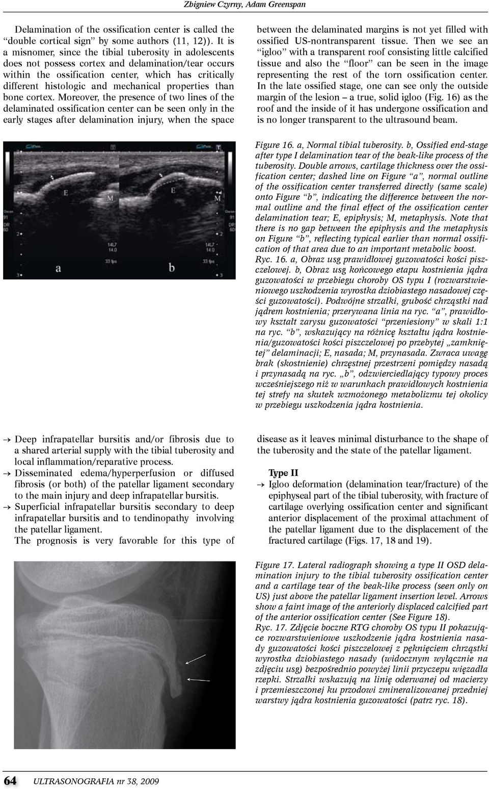 mechanical properties than bone cortex.