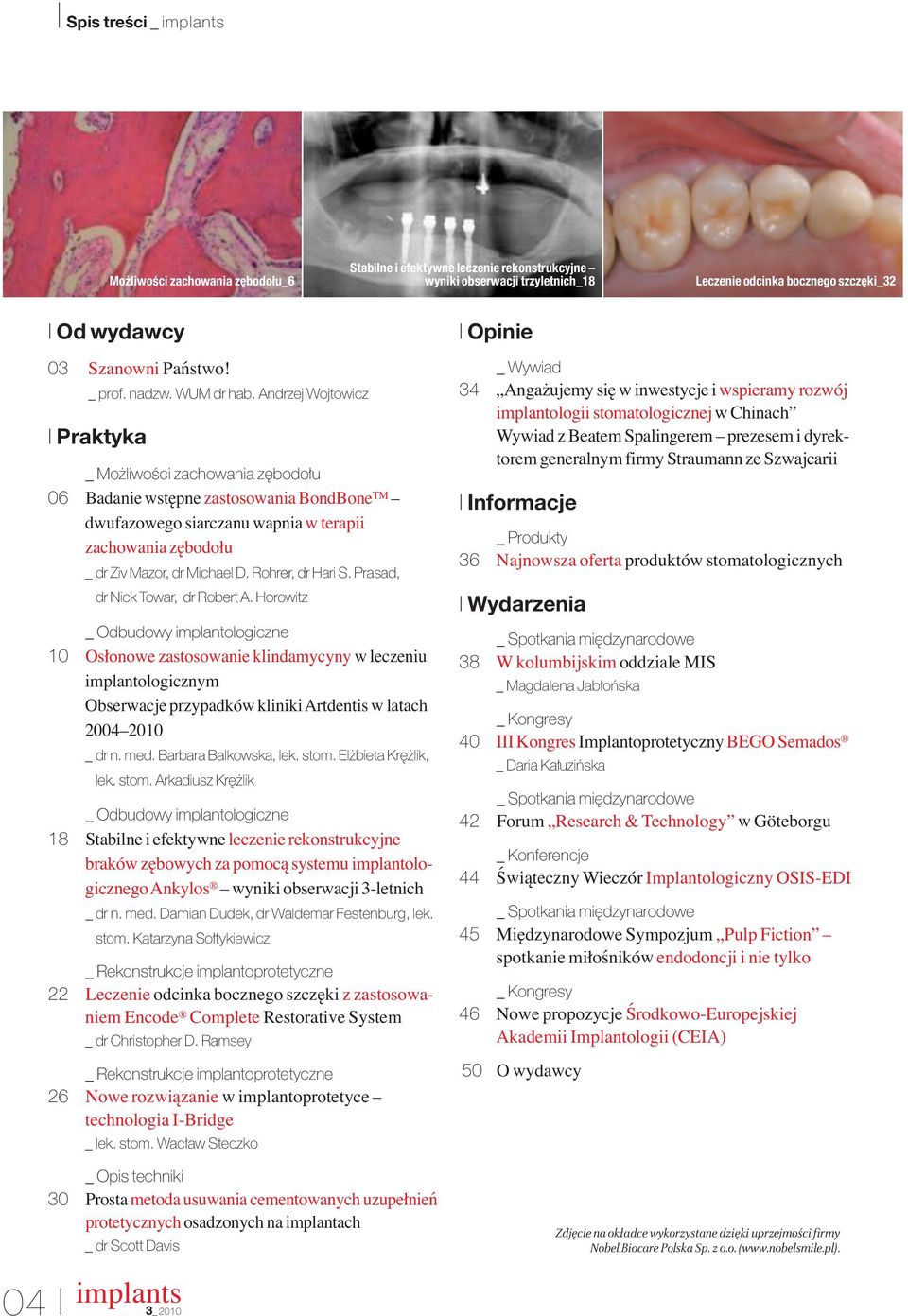 An drzej Woj to wicz I Praktyka _ Mo liwo ci zachowania z bodoδu 06 Badanie wstępne zastosowania BondBone TM dwufazowego siarczanu wapnia w terapii zachowania zębodołu _ dr Ziv Mazor, dr Michael D.
