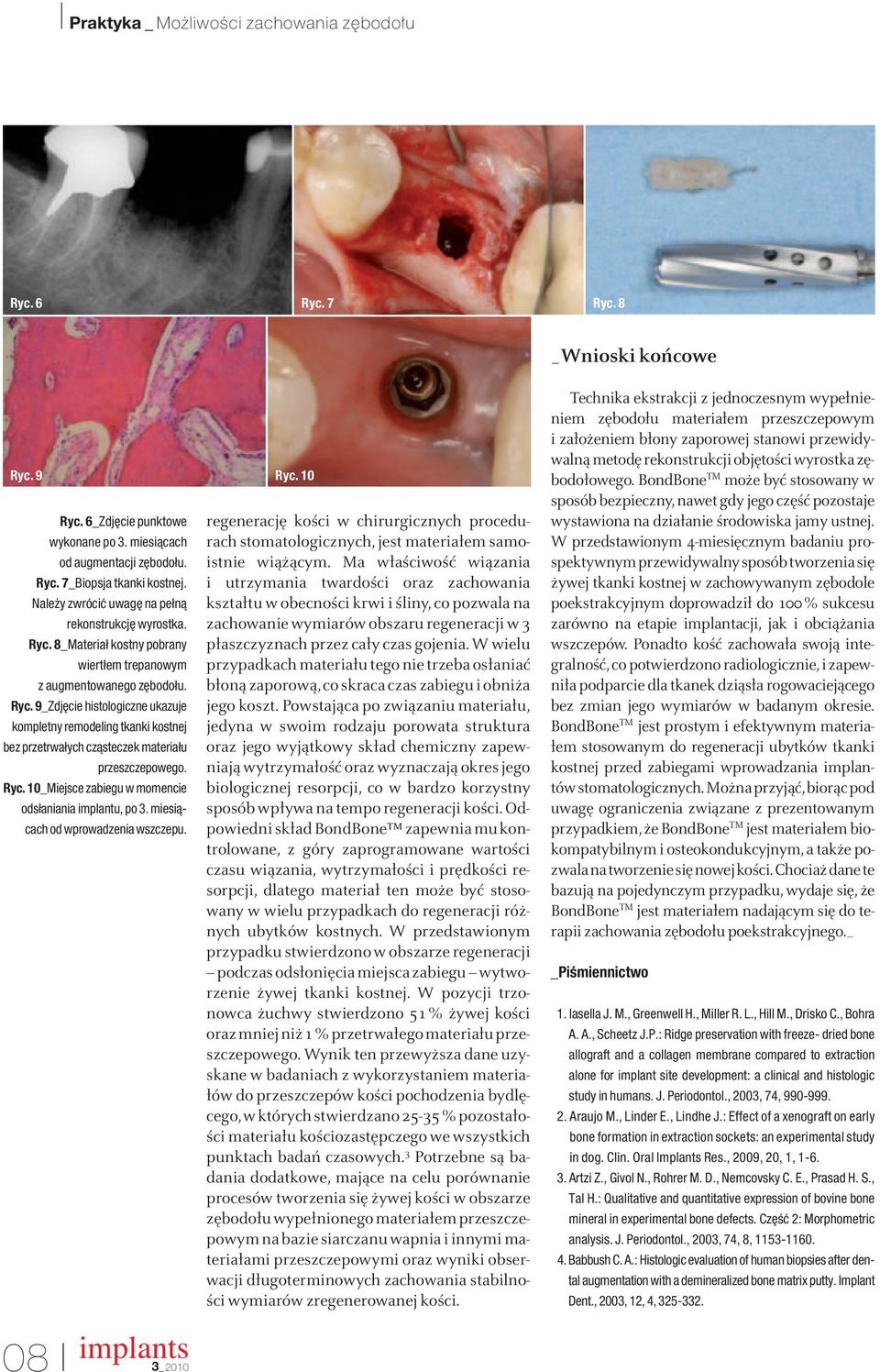 Ryc. 10_Miejsce zabiegu w momencie odsłaniania implantu, po 3. miesiàcach od wprowadzenia wszczepu.