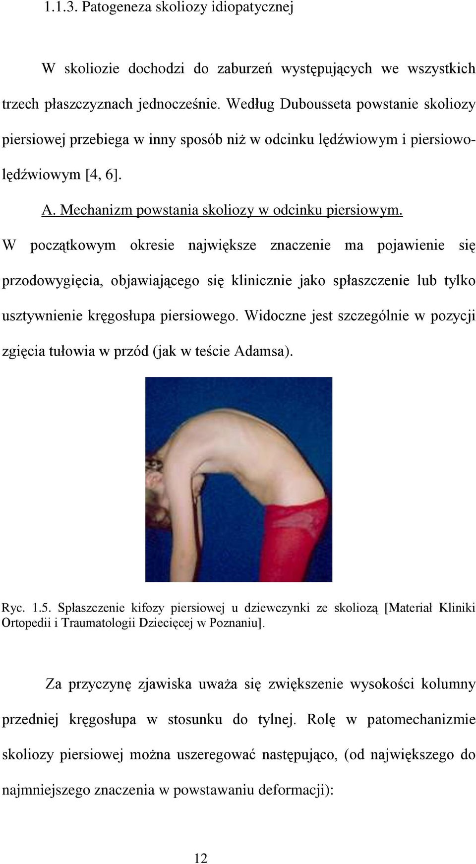 W początkowym okresie największe znaczenie ma pojawienie się przodowygięcia, objawiającego się klinicznie jako spłaszczenie lub tylko usztywnienie kręgosłupa piersiowego.