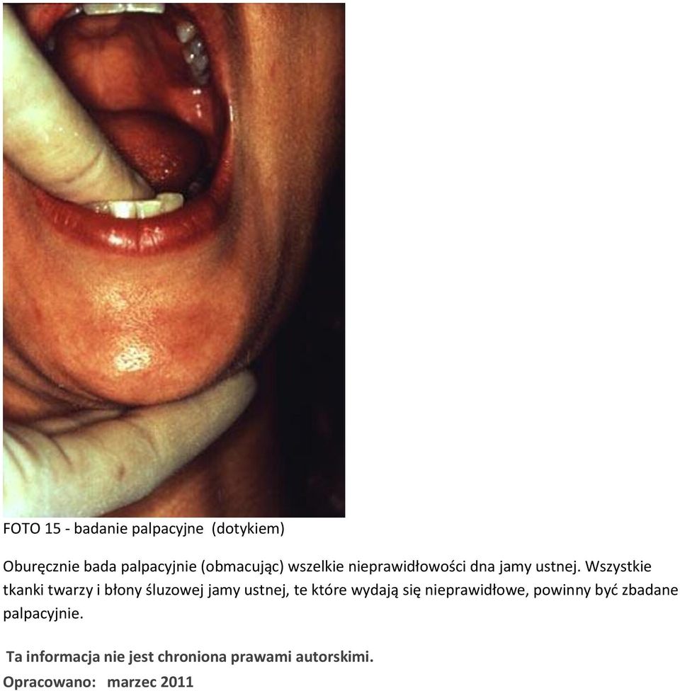 Wszystkie tkanki twarzy i błony śluzowej jamy ustnej, te które wydają się