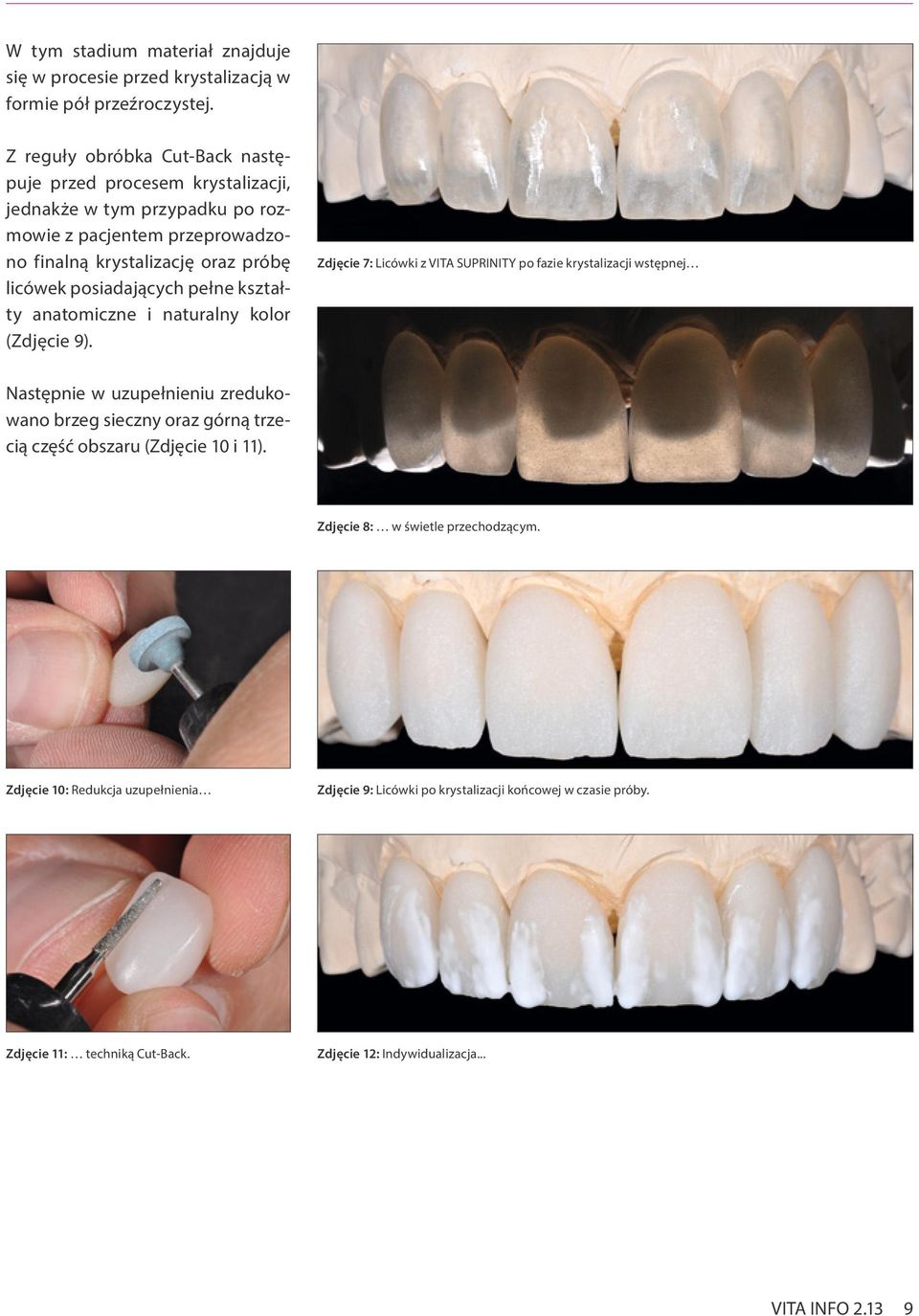 posiadających pełne kształty anatomiczne i naturalny kolor (Zdjęcie 9).