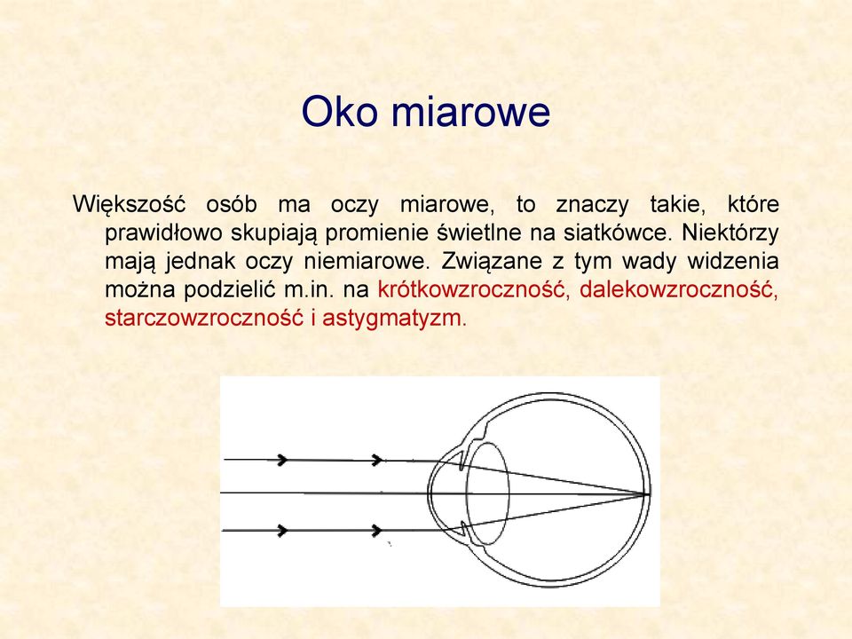 Niektórzy mają jednak oczy niemiarowe.