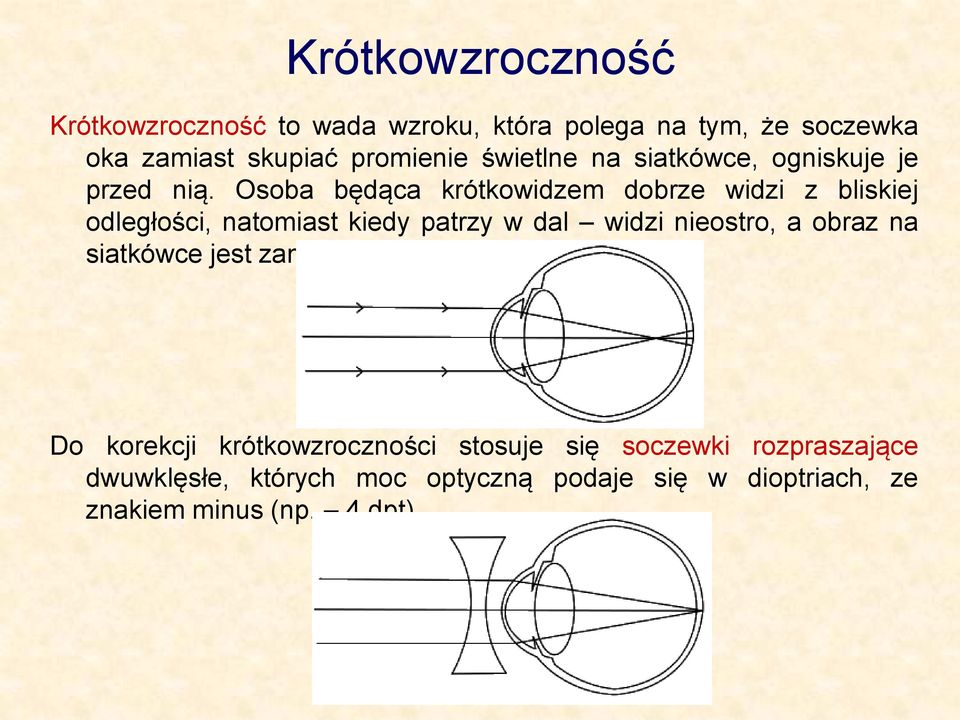 Osoba będąca krótkowidzem dobrze widzi z bliskiej odległości, natomiast kiedy patrzy w dal widzi nieostro, a