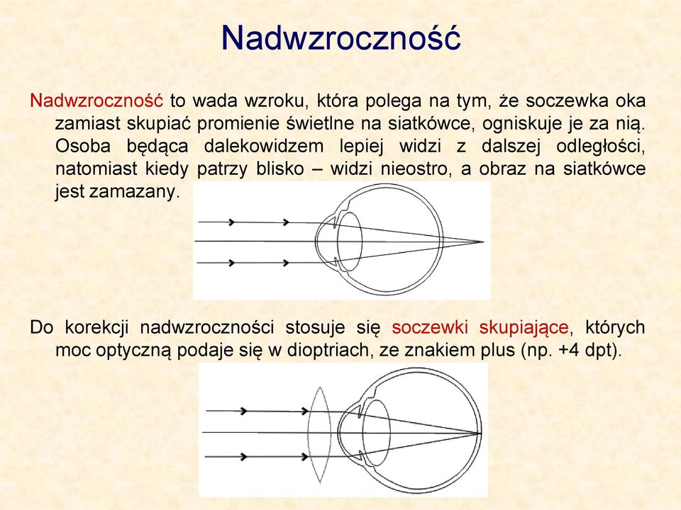 Osoba będąca dalekowidzem lepiej widzi z dalszej odległości, natomiast kiedy patrzy blisko widzi nieostro,