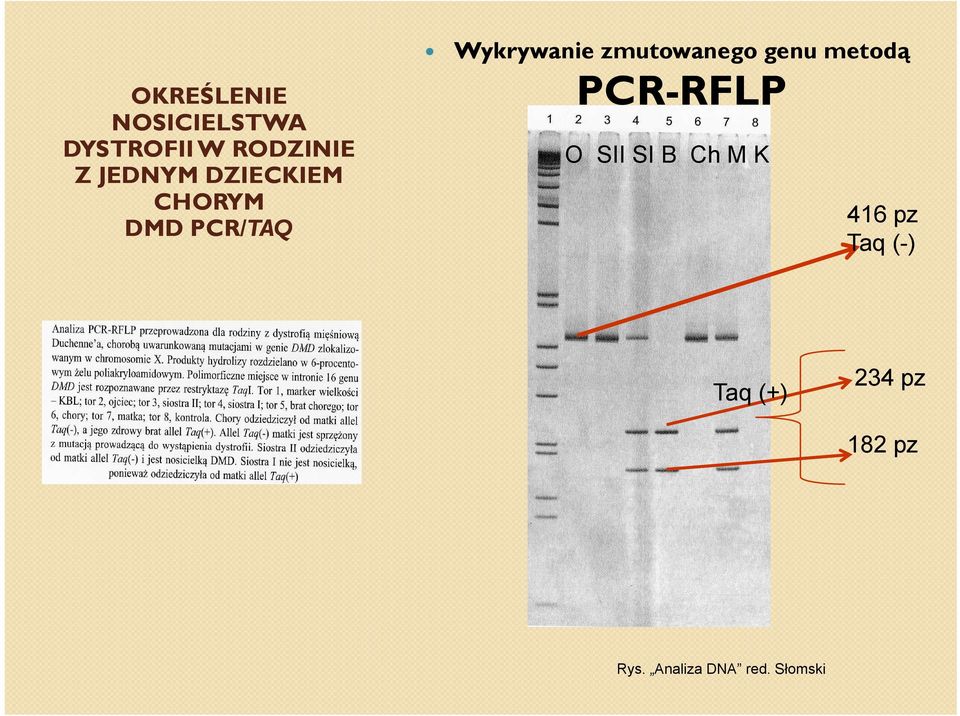 genu metodą PCR-RFLPRFLP O SII SI B Ch M K 416 pz Taq