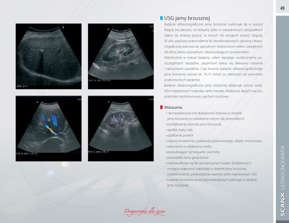 W celu poprawy przewodzenia fal ultradźwiękowych, głowicę ultrasonograficzną pokrywa się specjalnym bezbarwnym żelem (obojętnym dla skóry, łatwo usuwalnym, niepowodującym przebarwień).