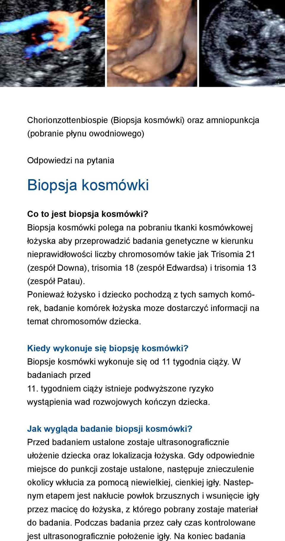 (zespół Edwardsa) i trisomia 13 (zespół Patau). Ponieważ łożysko i dziecko pochodzą z tych samych komórek, badanie komórek łożyska moze dostarczyć informacji na temat chromosomów dziecka.