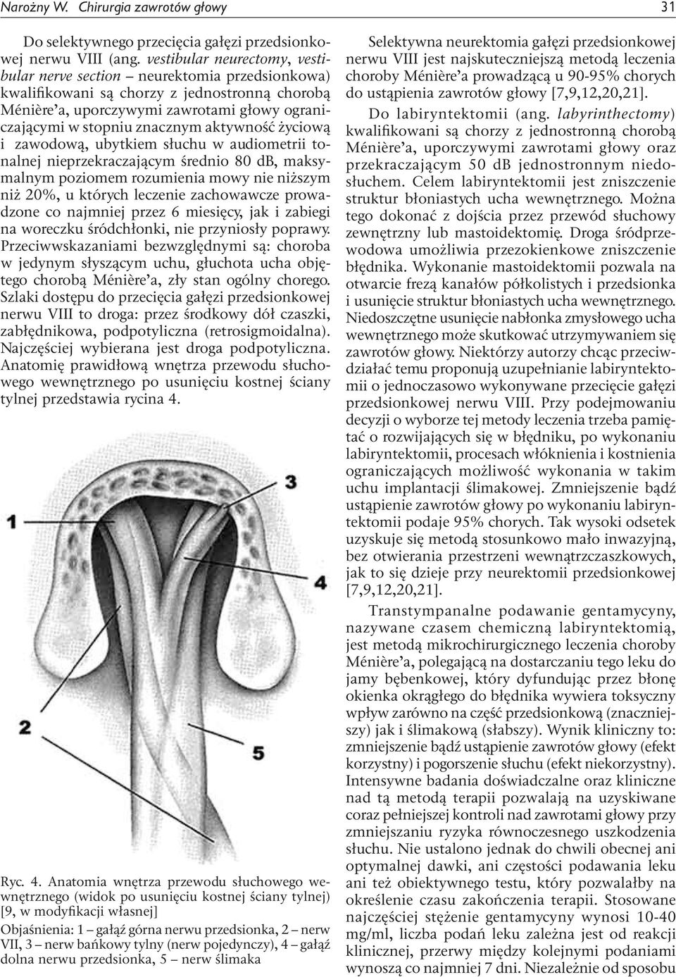 aktywność życiową i zawodową, ubytkiem słuchu w audiometrii tonalnej nieprzekraczającym średnio 80 db, maksymalnym poziomem rozumienia mowy nie niższym niż 20%, u których leczenie zachowawcze