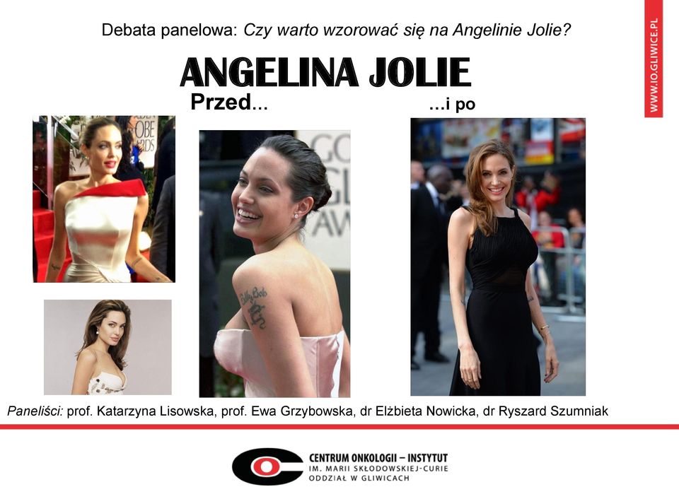 ANGELINA JOLIE Przed i po Paneliści: prof.