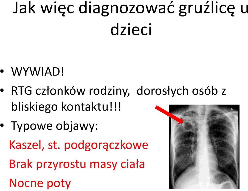 bliskiego kontaktu!!! Typowe objawy: Kaszel, st.