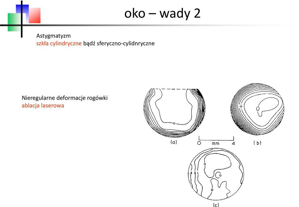 sferyczno-cylidnryczne oko