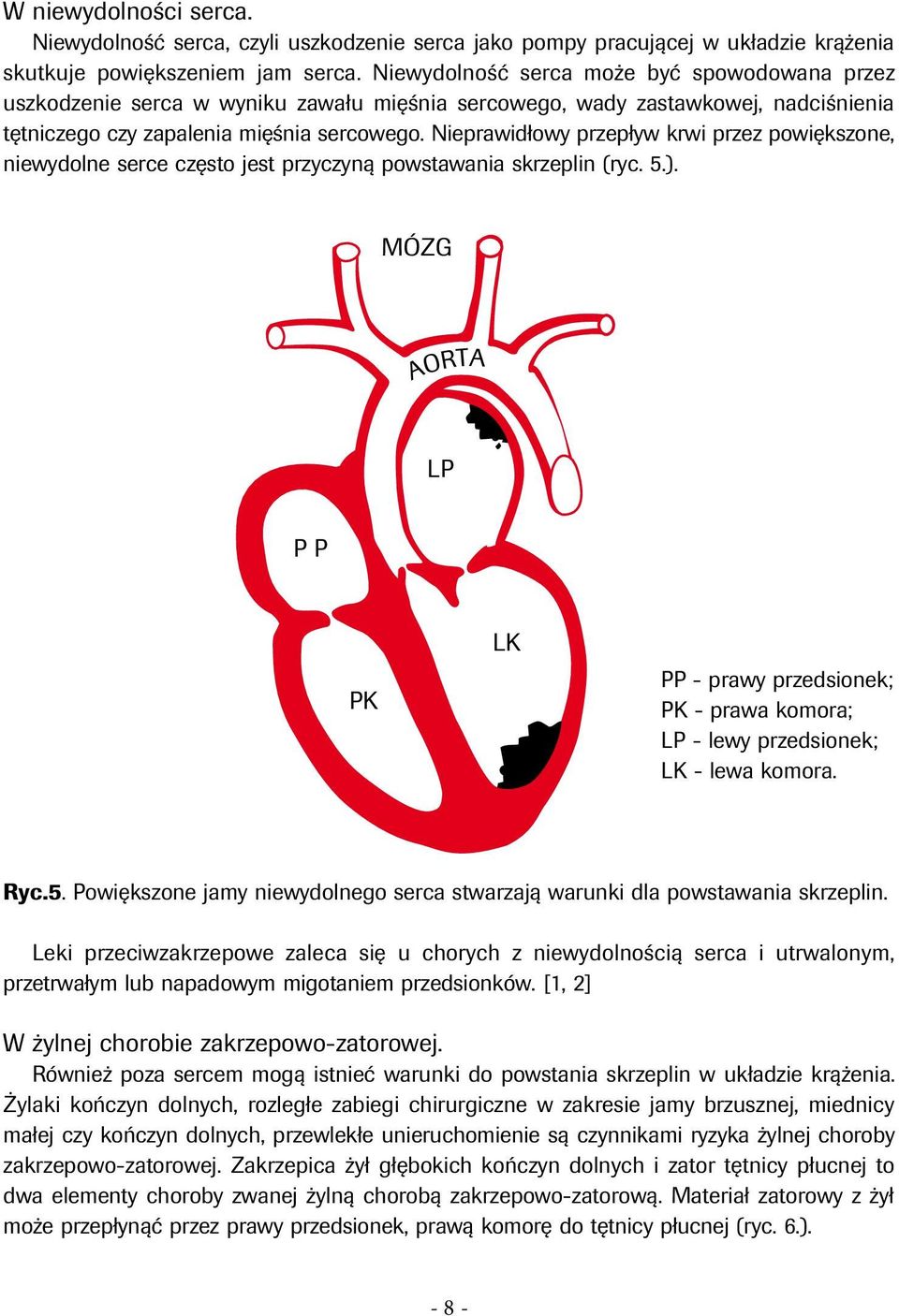Nieprawidłowy przepływ krwi przez powiększone, niewydolne serce często jest przyczyną powstawania skrzeplin (ryc. 5.).