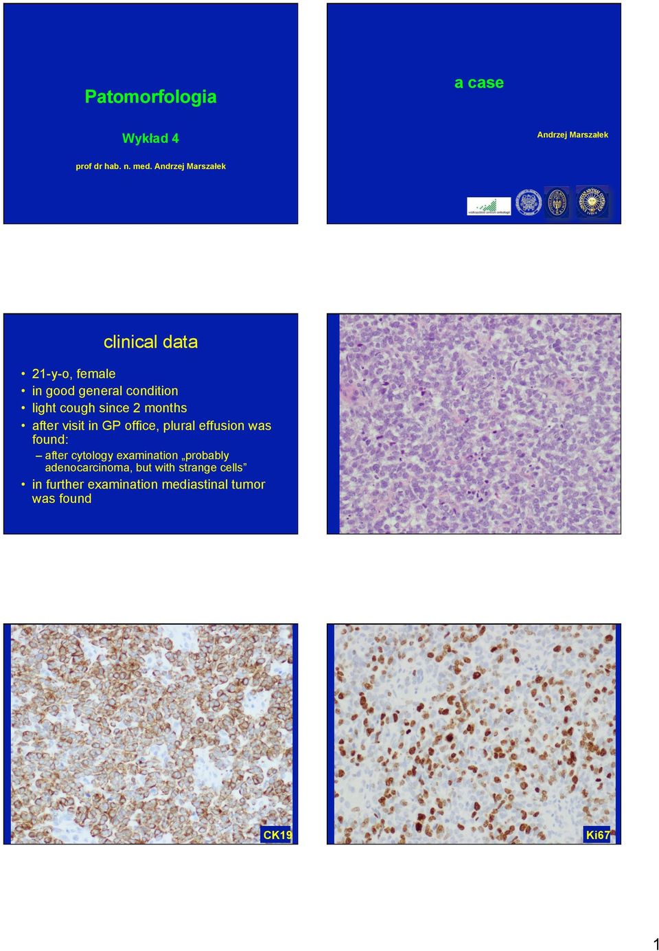 since 2 months after visit in GP office, plural effusion was found: after cytology