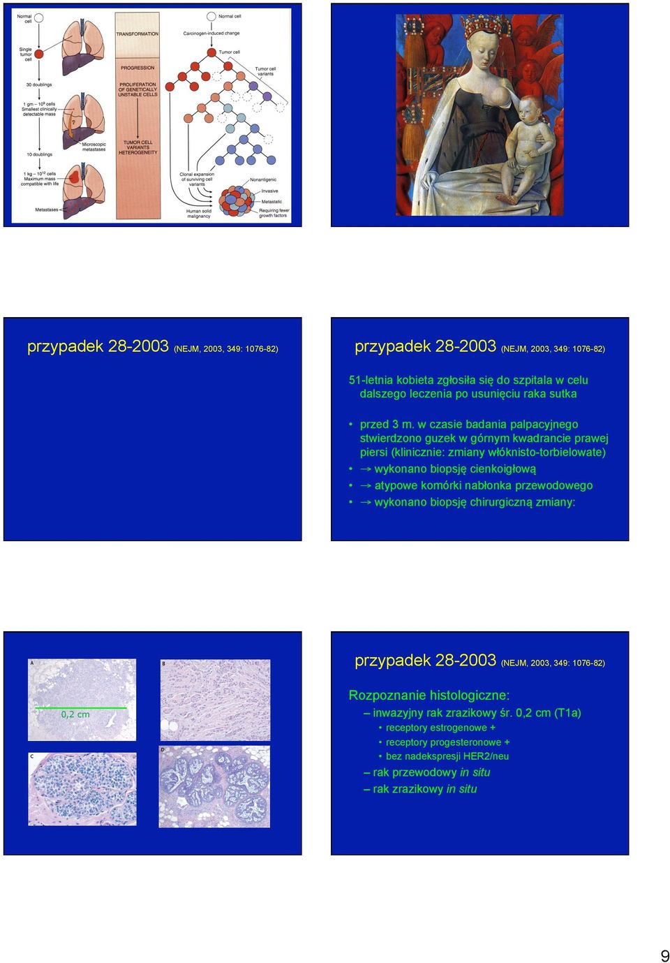 w czasie badania palpacyjnego stwierdzono guzek w górnym kwadrancie prawej piersi (klinicznie: zmiany włóknisto-torbielowate) wykonano biopsję cienkoigłową atypowe