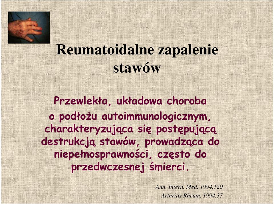 destrukcją stawów, prowadząca do niepełnosprawności, często do