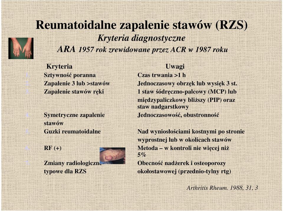 Symetryczne zapalenie Jednoczasowość, obustronność stawów 5. Guzki reumatoidalne Nad wyniosłościami kostnymi po stronie wyprostnej lub w okolicach stawów 6.