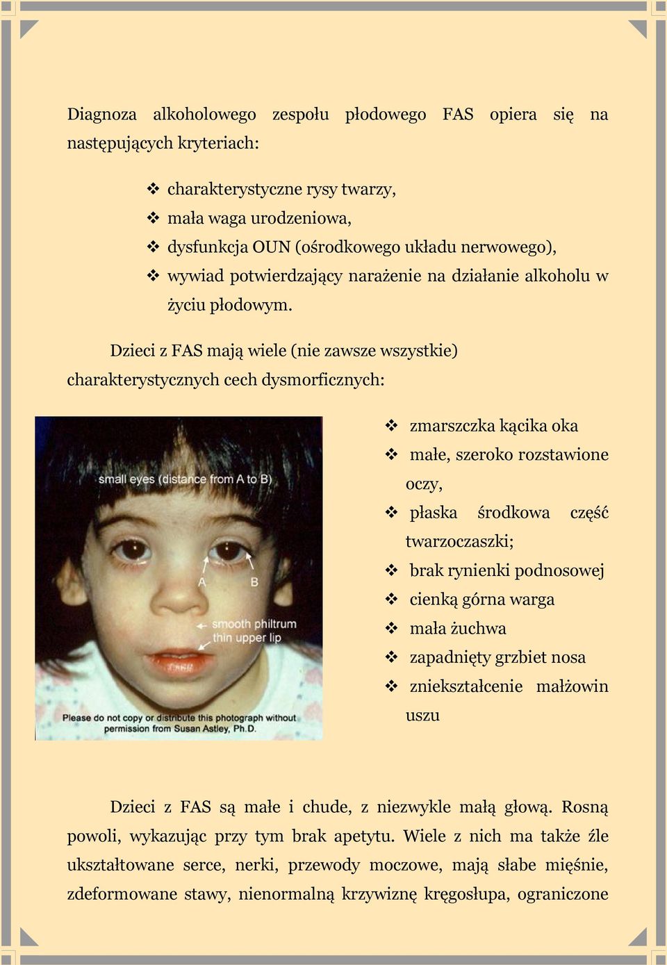 Dzieci z FAS mają wiele (nie zawsze wszystkie) charakterystycznych cech dysmorficznych: zmarszczka kącika oka małe, szeroko rozstawione oczy, płaska środkowa część twarzoczaszki; brak rynienki