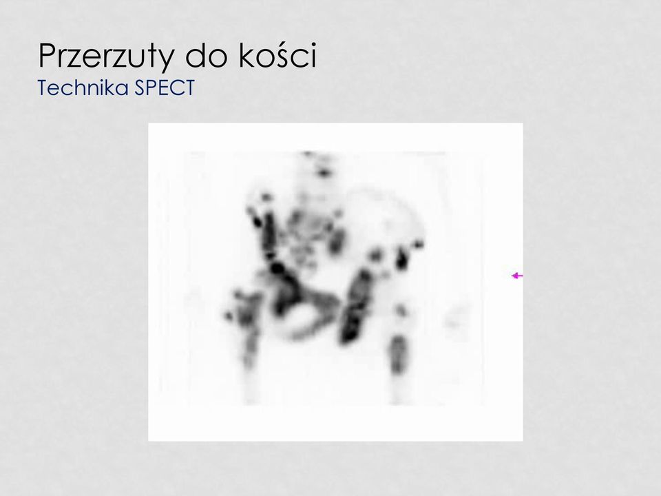 Technika