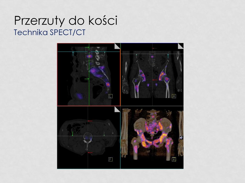 Technika