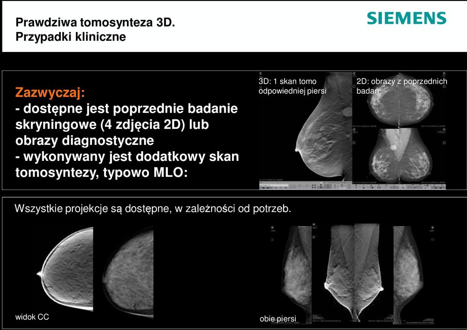 2D) lub obrazy diagnostyczne - wykonywany jest dodatkowy skan tomosyntezy, typowo MLO: