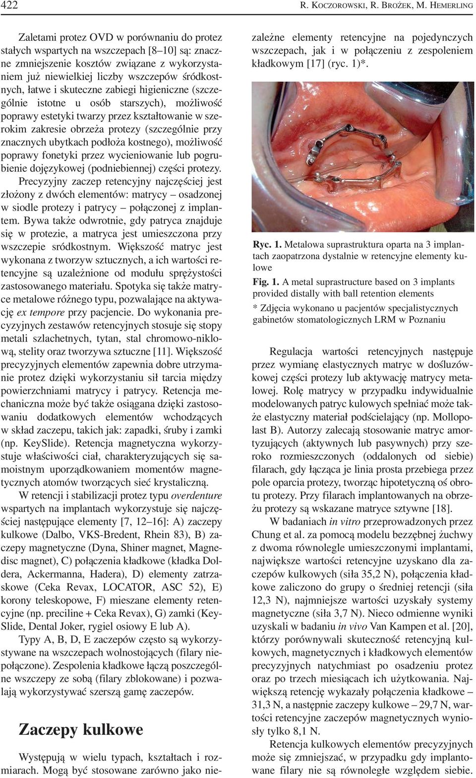 nych, łatwe i skuteczne zabiegi higieniczne (szcze gólnie istotne u osób starszych), możliwość poprawy estetyki twarzy przez kształtowanie w sze rokim zakresie obrzeża protezy (szczególnie przy