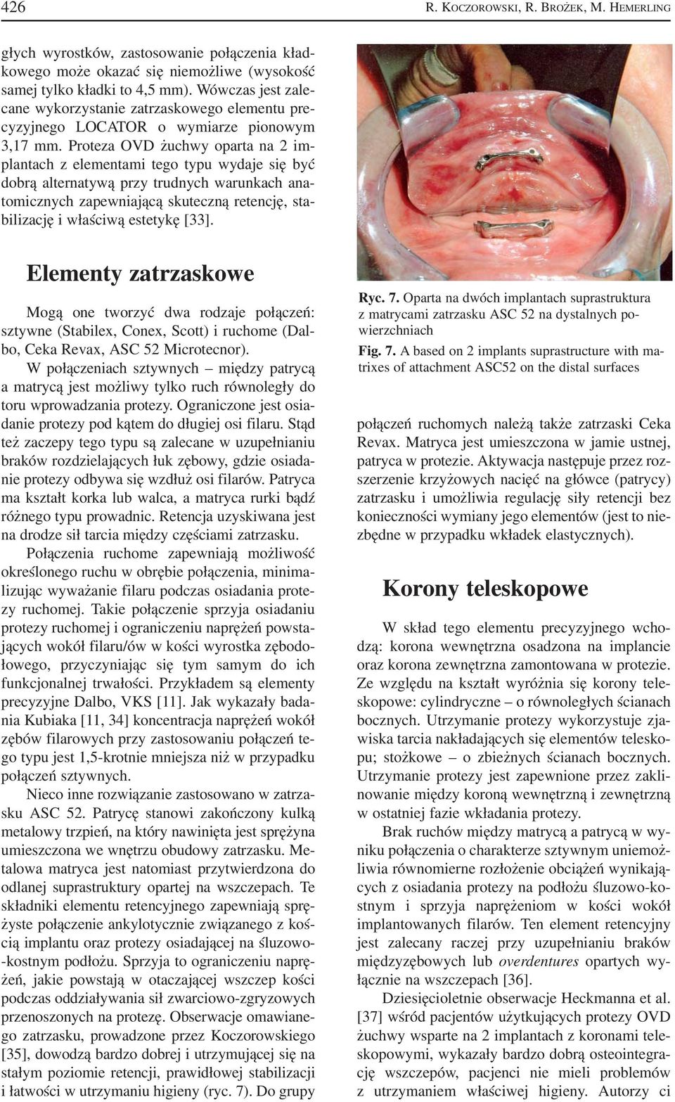 Proteza OVD żuchwy oparta na 2 im plantach z elementami tego typu wydaje się być dobrą alternatywą przy trudnych warunkach ana tomicznych zapewniającą skuteczną retencję, sta bilizację i właściwą
