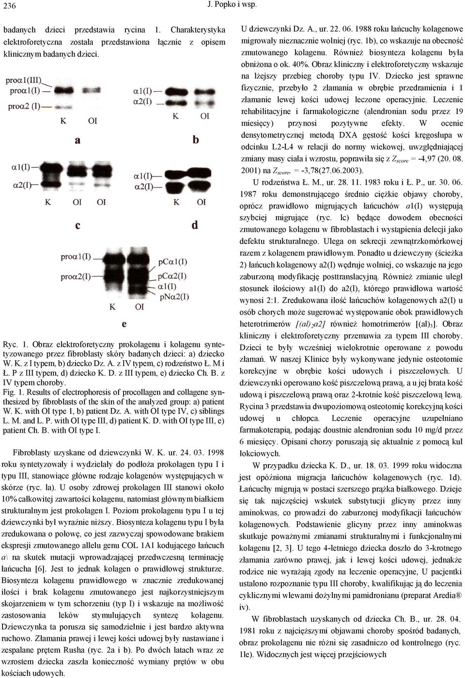 Results of electrophoresis of procollagen and collagene synthesized by fibroblasts of the skin of the analyzed group: a) patient W. K. with OI type 1, b) patient Dz. A. with OI type IV, c) siblings L.
