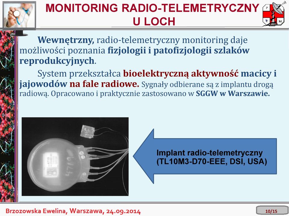 System przekształca bioelektryczną aktywność macicy i jajowodów na fale radiowe.