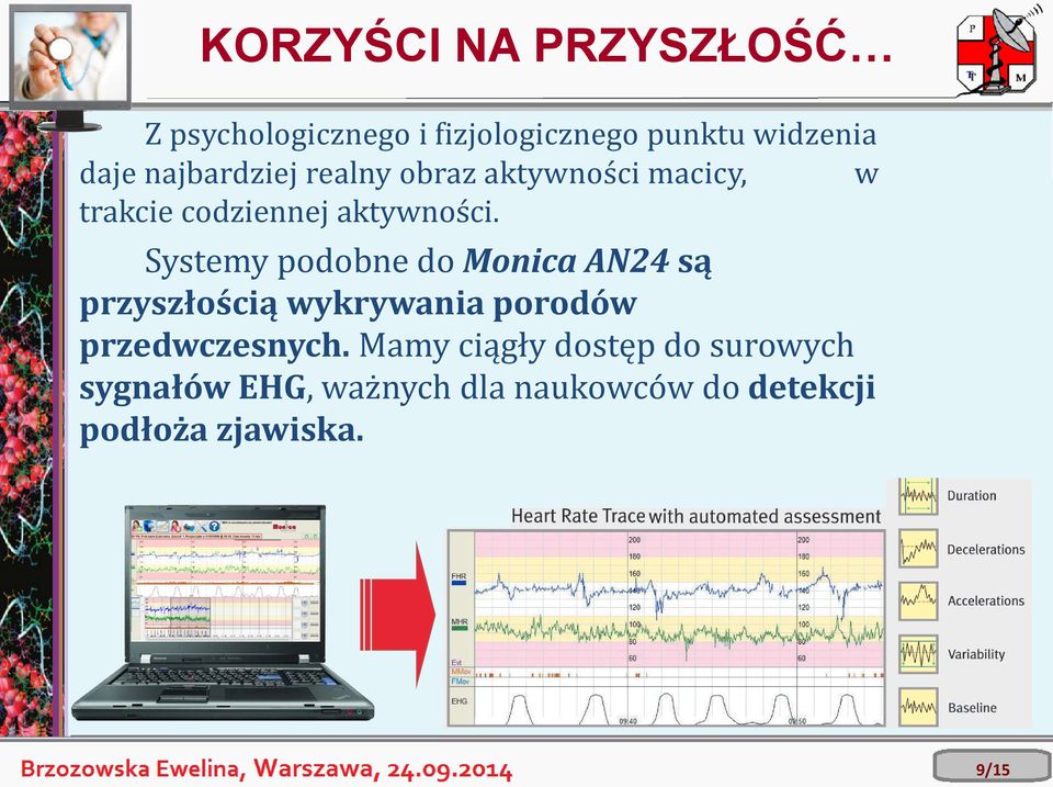 Systemy podobne do Monica AN24 są przyszłością wykrywania porodów przedwczesnych.