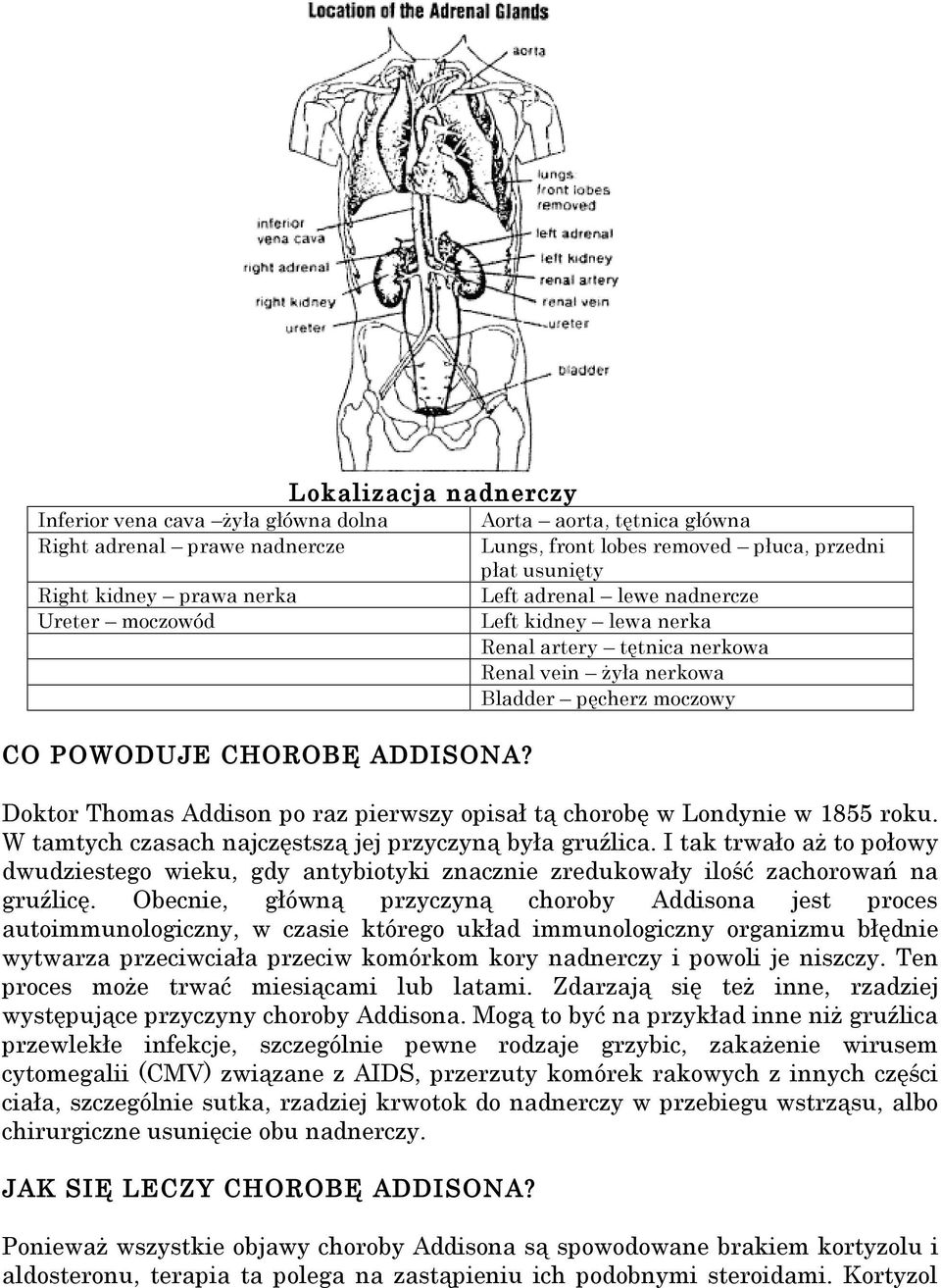 pęcherz moczowy Doktor Thomas Addison po raz pierwszy opisał tą chorobę w Londynie w 1855 roku. W tamtych czasach najczęstszą jej przyczyną była gruźlica.