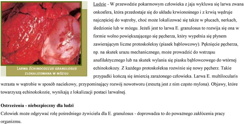 granulosus to rozwija się ona w formie wolno powiększającego się pęcherza, który wypełnia się płynem zawierającym liczne protoskoleksy (piasek bąblowcowy). Pęknięcie pęcherza, np.