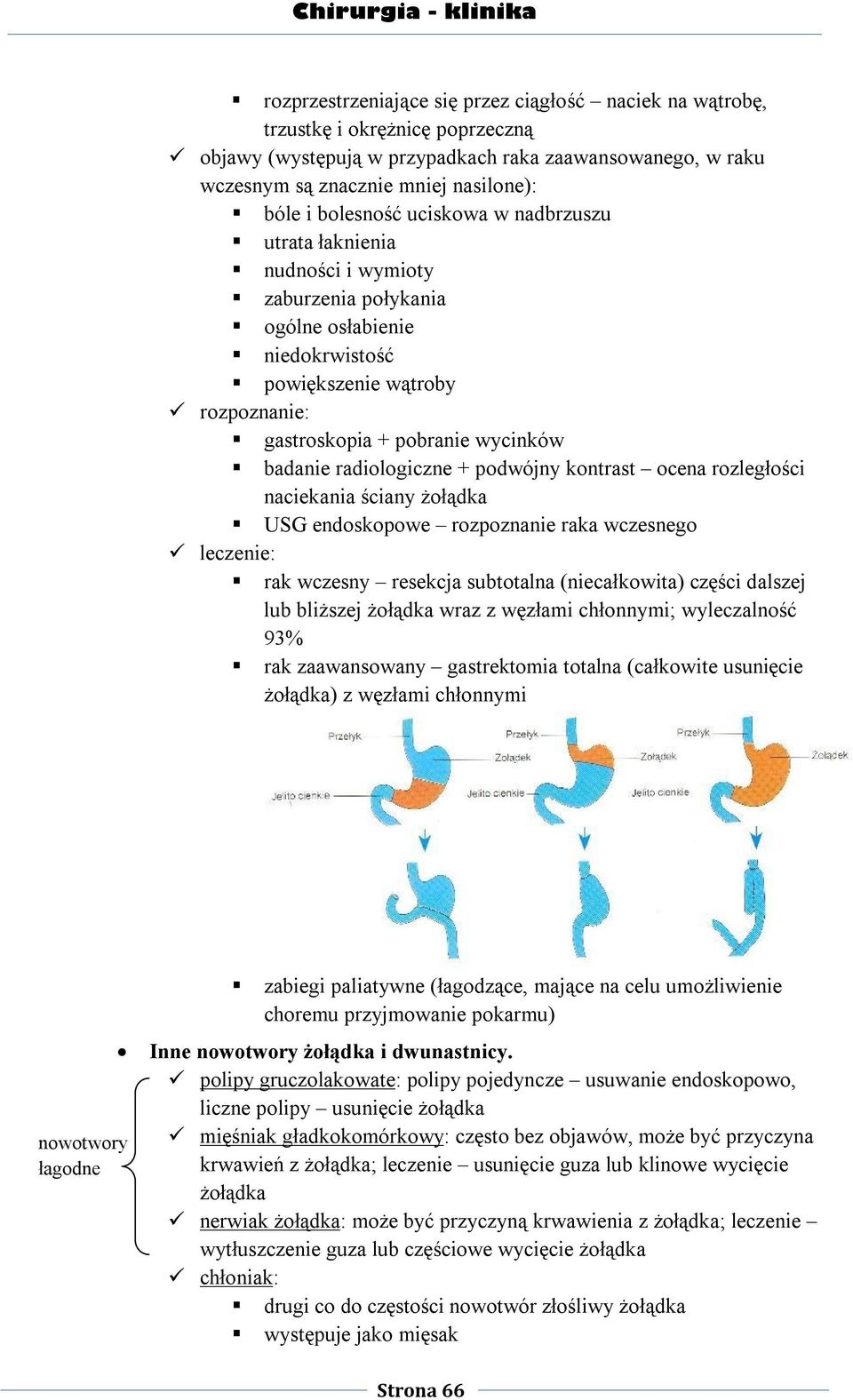 radiologiczne + podwójny kontrast ocena rozległości naciekania ściany żołądka USG endoskopowe rozpoznanie raka wczesnego leczenie: rak wczesny resekcja subtotalna (niecałkowita) części dalszej lub