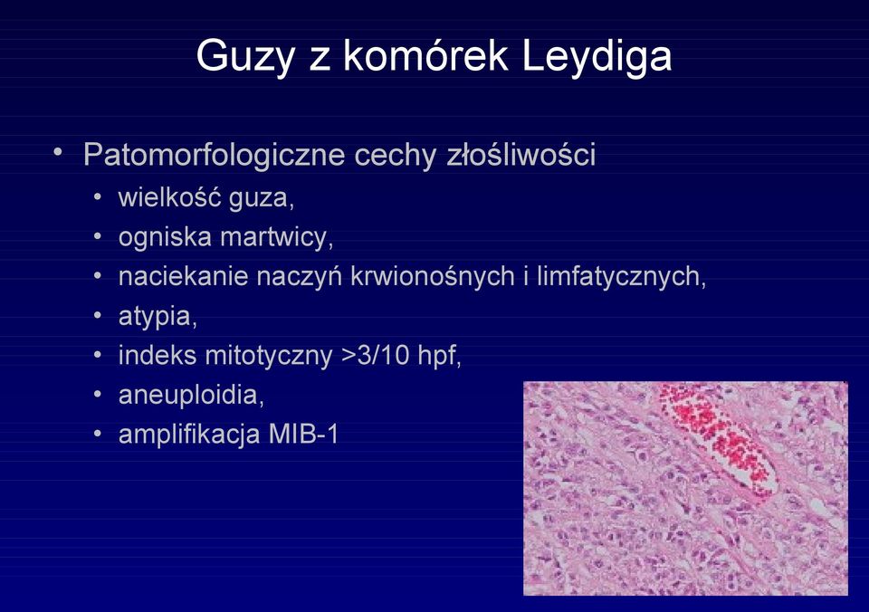 naciekanie naczyń krwionośnych i limfatycznych,