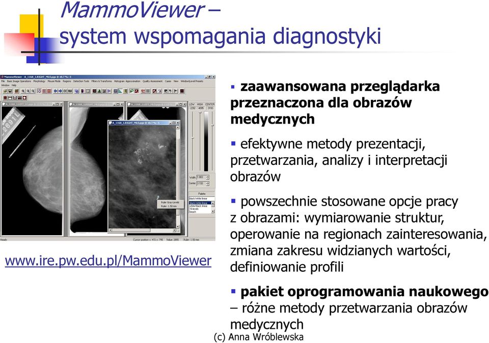 pl/mammoviewer powszechnie stosowane opcje pracy z obrazami: wymiarowanie struktur, operowanie na regionach