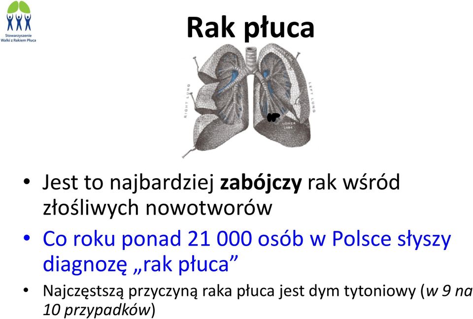 Polsce słyszy diagnozę rak płuca Najczęstszą
