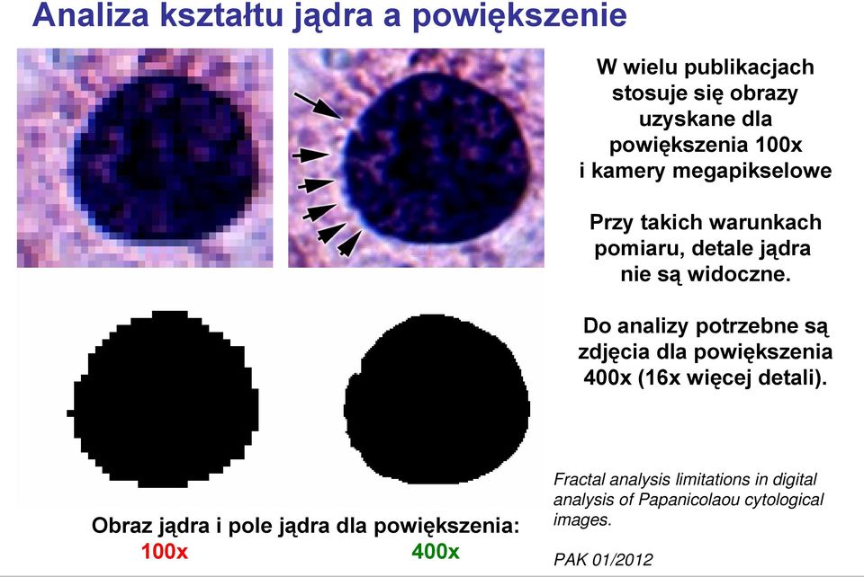 Do analizy potrzebne są zdjęcia dla powiększenia 400x (16x więcej detali).