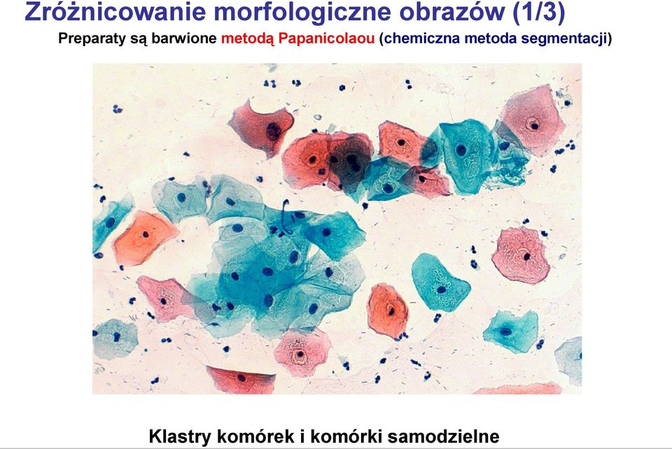 Papanicolaou (chemiczna metoda