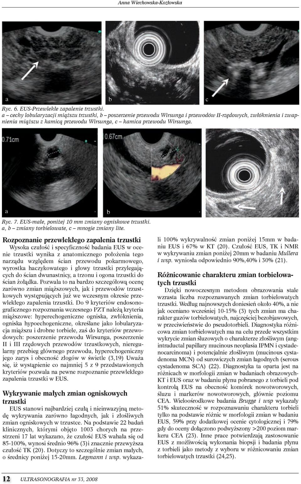 EUS-małe, poniżej 10 mm zmiany ogniskowe trzustki. a, b zmiany torbielowate, c mnogie zmiany lite.
