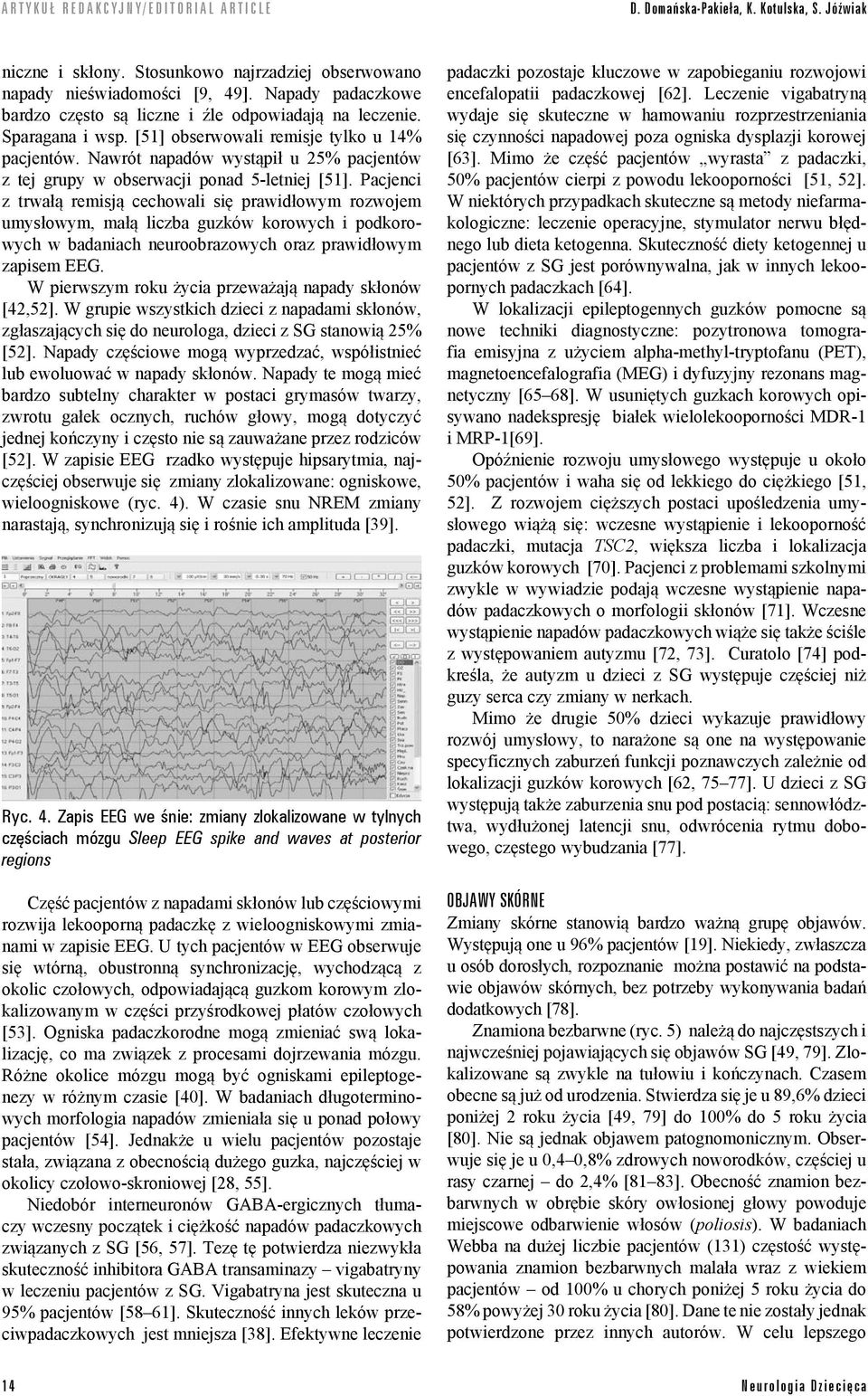 Pacjenci z trwałą remisją cechowali się prawidłowym rozwojem umysłowym, małą liczba guzków korowych i podkorowych w badaniach neuroobrazowych oraz prawidłowym zapisem EEG.