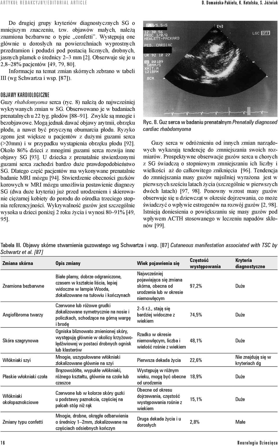 Obserwuje się je u 2,8 28% pacjentów [49, 79, 80]. Informacje na temat zmian skórnych zebrano w tabeli III (wg Schwartza i wsp. [87]). OBJAWY KARDIOLOGICZNE Guzy rhabdomyoma serca (ryc.